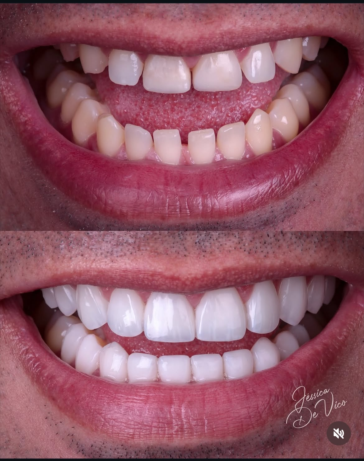 Antes e depois — caso 5