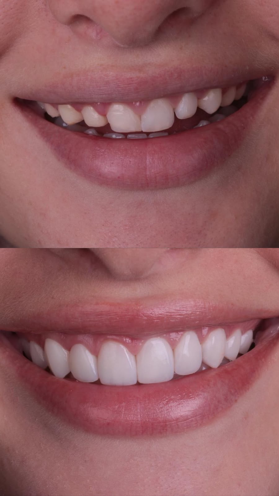 Antes e depois — caso 2