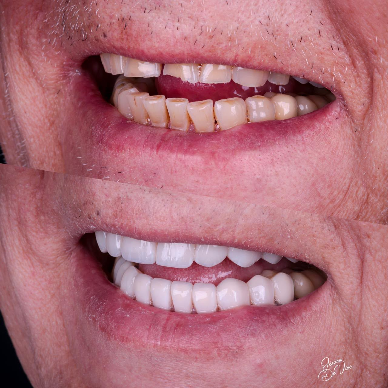 Antes e depois — caso 3