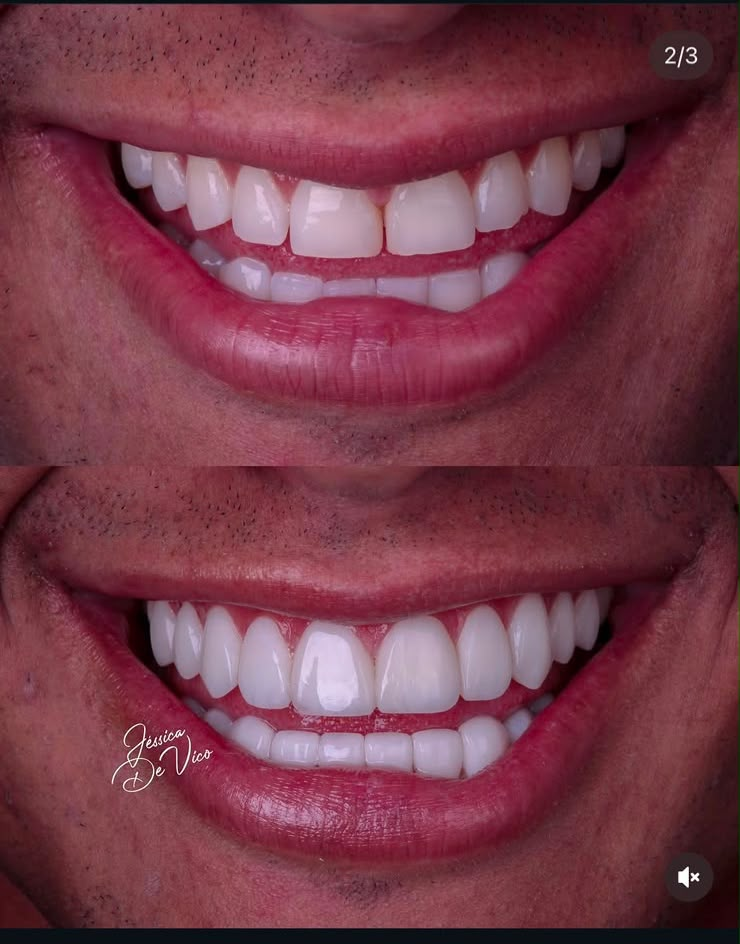 Antes e depois — caso 8