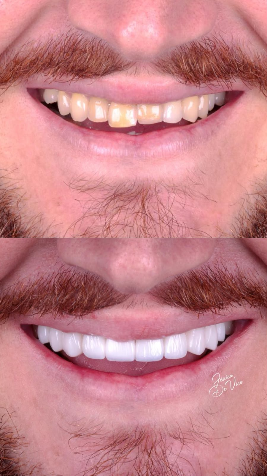 Antes e depois — caso 1