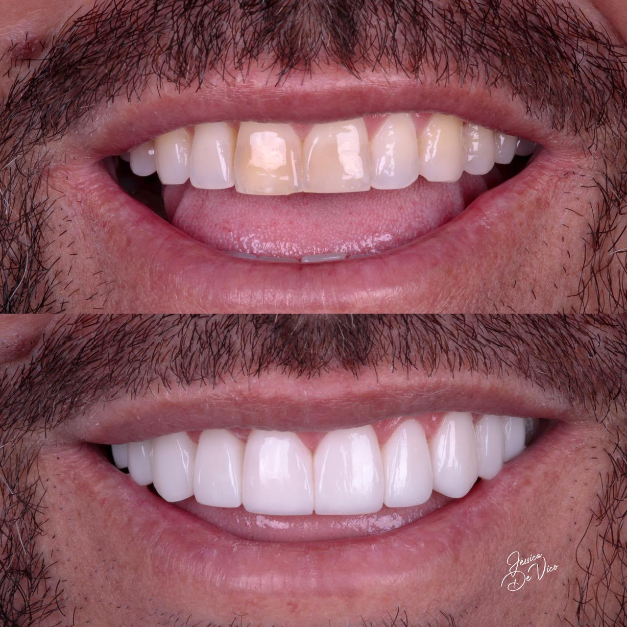 Antes e depois — caso 4